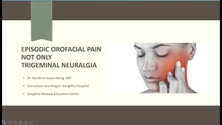 Episodic orofacial pain not only trigeminal neuralgia [upl. by Naujad]