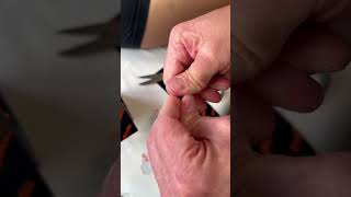 Taping of the tennis elbow with a trigger point  the most effective way how to kill the pain [upl. by Sion]