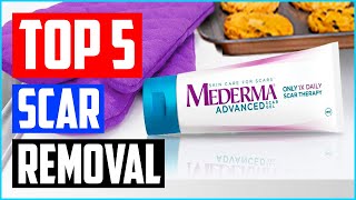 Best Scar Removal Creams in 2023 [upl. by Siari]