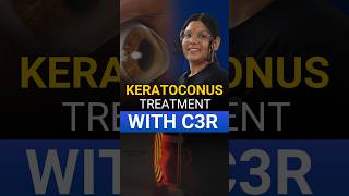 Live Keratoconus Treatment With C3R [upl. by Malkin]