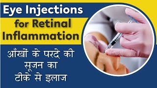 All about Eye Injections for Retina  Eye Cancer injection  आँखों के परदे की सूजन का टीके से इलाज [upl. by Zenobia]