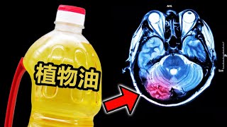 植物油把你变笨！损害大脑！Vegetable Oil Lower Your IQ Poison Your Brain [upl. by Paymar]