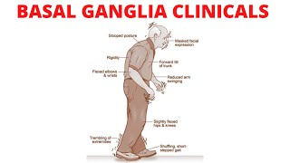 The Basal Ganglia Clinical Anatomy  Parkinson’s Disease  Chorea  Huntington Disease [upl. by Virgina117]