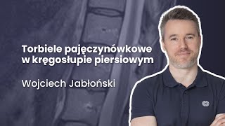 Torbiele pajęczynówkowe w kręgosłupie piersiowym  49 Radiologia [upl. by Partan]