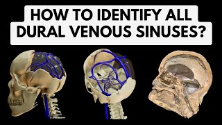 Dural venous sinuses  Identification in a 3D Model amp Cadaveric Specimen  Head Neck Anatomy [upl. by Mayhs]