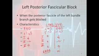 12 Lead Interpretation Part 42 Bundle Branch and Fascicular Blocks [upl. by Ladnek]