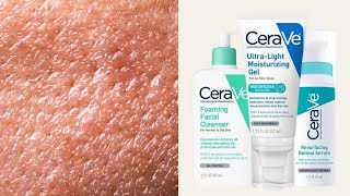 Top 5 CeraVe Skincare for Oily  Combination Skin Types [upl. by Cogswell]