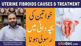 Uterine Fibroids Treatment  Bachedani Me Rasoli Kaise Hoti Hai Fibroids Ka Ilaj  Fibroid Symptoms [upl. by Atnahs832]