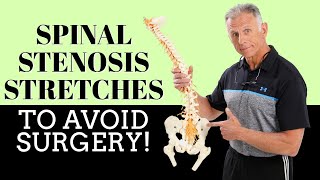 Best 3 Stretches To Quickly Remedy Lumbar Spinal Stenosis amp Avoid Surgery [upl. by Esetal]