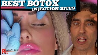 Botox Injection Sites Dr Rajani [upl. by Nallij]