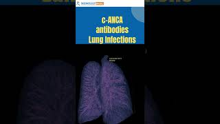 ANCA antibodies  what does it mean [upl. by Ayet]