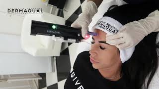 DERMAQUAL DERMAECLAT SKIN WHITENING MESOTHERAPY WITH FORZA MMS 007 [upl. by Ahsauqal]