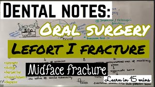 LEFORT I FRACTURE  MIDFACE FRACTURE  ORAL SURGERY  imp [upl. by Ahcatan]