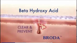 Microdermabrasion Acne Scars How To Remove Acne Scars Get Broda Skincare FREE Trial [upl. by Occer434]