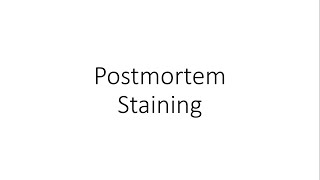 Postmortem staining  lividity  hypostasis  Forensic Medicine FMT [upl. by Soutor]