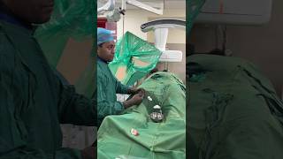 देखिए कैसे होता है वैरिकोसेल का इलाज  Live Varicocele Embolization shortsfeed2024 livesurgeryroom [upl. by Htebesile]