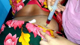 ivf buttock injection video Neuralgin Intramuscular injection buttock injection push 24 Ep 36 [upl. by Jariah729]