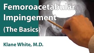 Femoroacetabular Impingement The Basics [upl. by Honeywell]