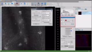 Fluorescence imaging with the ApoTome [upl. by Kuehn]