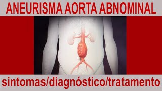 ANEURISMA NA AORTA ABDMINAL [upl. by Afnin]