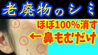 寝る前に騙されたと思ってシミ消し‼鼻をつまむだけでほうれい線、ゴルゴライン、白髪をなくす方法で垢抜け！目の下・顔のたるみも解消しガチガチ首コリまで一瞬で楽になるスキンケア【ダイエット整体師】 [upl. by Arraeic]