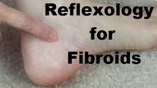 Reflexology for Fibroids  Massage Monday 274 [upl. by Ielirol241]