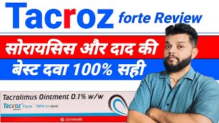 Tacroz Forte Ointment Review  Tacrolimus Ointment Uses Mode Of Action amp Side Effects In Hindi [upl. by Asenav546]