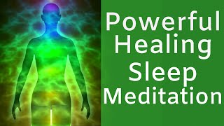 HEAL while you SLEEP  Powerful Sleep Meditation for Rapid Healing [upl. by Gowrie]