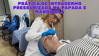 PRÁTICA DE INTRADERMO PRESSURIZADA NA PAPADA E MANDÍBULA [upl. by Lucine99]