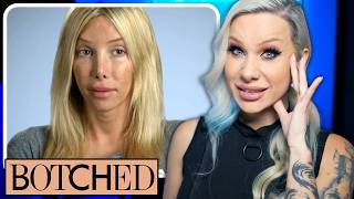 BOTCHED Is 24 trans plastic surgeries too many volume 3 [upl. by Tony342]