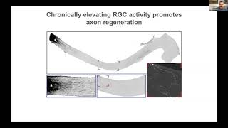 Visual stimulation and endogenous regeneration as treatment of vision loss [upl. by Enair]