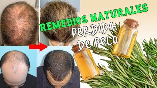 COMO HACER ACEITE DE ROMERO 🌿 LO MEJOR PARA CRECER EL CABELLO Y EVITAR LA CASPA  Bessy Dressy [upl. by Shornick]