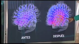 ¿QUÉ es la TÉCNICA de ESTIMULACIÓN del NERVIO VAGO❓❓ 👉🏼Sistema Nervioso Vegetativo ‼️ [upl. by Coltin]