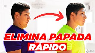 🔴 5 EJERCICIOS para ELIMINAR y REDUCIR la PAPADA en SOLO 3 MINUTOS😱 [upl. by Wamsley]