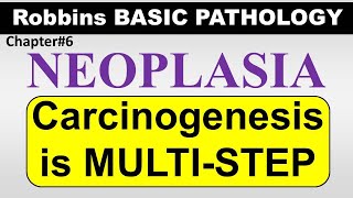 Chp6Part5 Robbins Basic Patho  CARCINOGENESIS A Multi step Process General Pathology Neoplasia [upl. by Cassidy723]