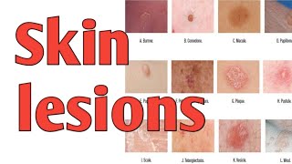 Primary skin lesionsdermatology nursingstudy 7 may 2020 [upl. by Rodge]