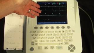 CardioTech GT 300 Part III Patient Entry  Basic Use [upl. by Starks]