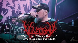 Vulvectomy quotDeformed Tits Collectionquot Live  Xapada Fest 2024 [upl. by Kecaj437]