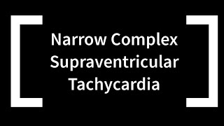 Narrow Complex Supraventricular Tachycardia [upl. by Asyar]