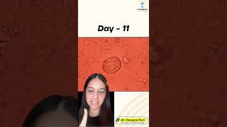 Welcome to today’s Micro Mystery  Can you crack this case  Day 11  Dr Devyani Puri [upl. by Laemsi]