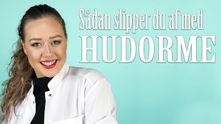 Sådan slipper du af med hudorme  SKØNHEDSLABORATORIET [upl. by Nilrem]