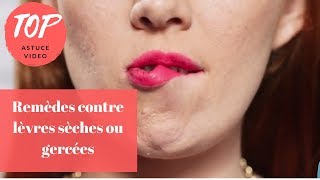 Top 5 Astuces  Lèvres gercées ou sèches Remèdes naturels [upl. by Annail17]