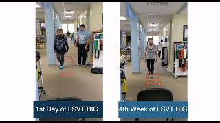 LSVT BIG 4 week improvement for patient with Parkinsons [upl. by Perry35]