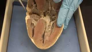 Cardiovascular system Part 3a  Heart dissection [upl. by Duwe584]