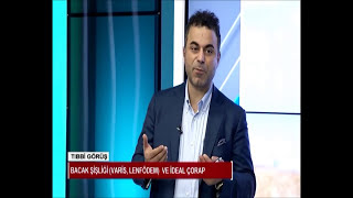 Sülük tedavisi varis hastalarında kullanılmalı mı  Prof Dr Ahmet AKGÜL [upl. by Rudelson975]