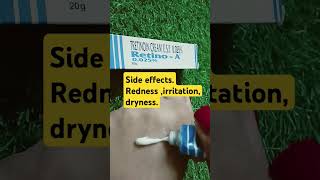 tretinoin cream retino A 0025 review tretinoincream  retino Aviral review ytshorts acne [upl. by Stine]