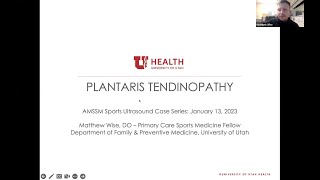 Plantaris Tendinopathy with Dr Matthew Wise  AMSSM Sports US Case Presentation [upl. by Lewison]