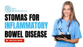 TYPES OF STOMAS IN INFLAMMATORY BOWEL DISEASE IBD I ILEOSTOMY VS COLOSTOMY I THE GRUMBLING GUT [upl. by Aihtekal]