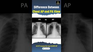 Difference between Chest AP amp PA view apview paview ChestAP Chestpa testpaperlive xray [upl. by Enelyak]