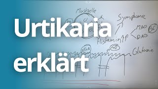 Urtikaria Nesselsucht einfach erklärt [upl. by Anilok]